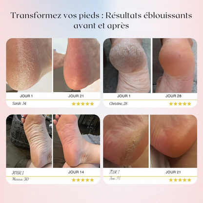 Meuleuse Électrique Rechargeable – Spécial Peaux Mortes